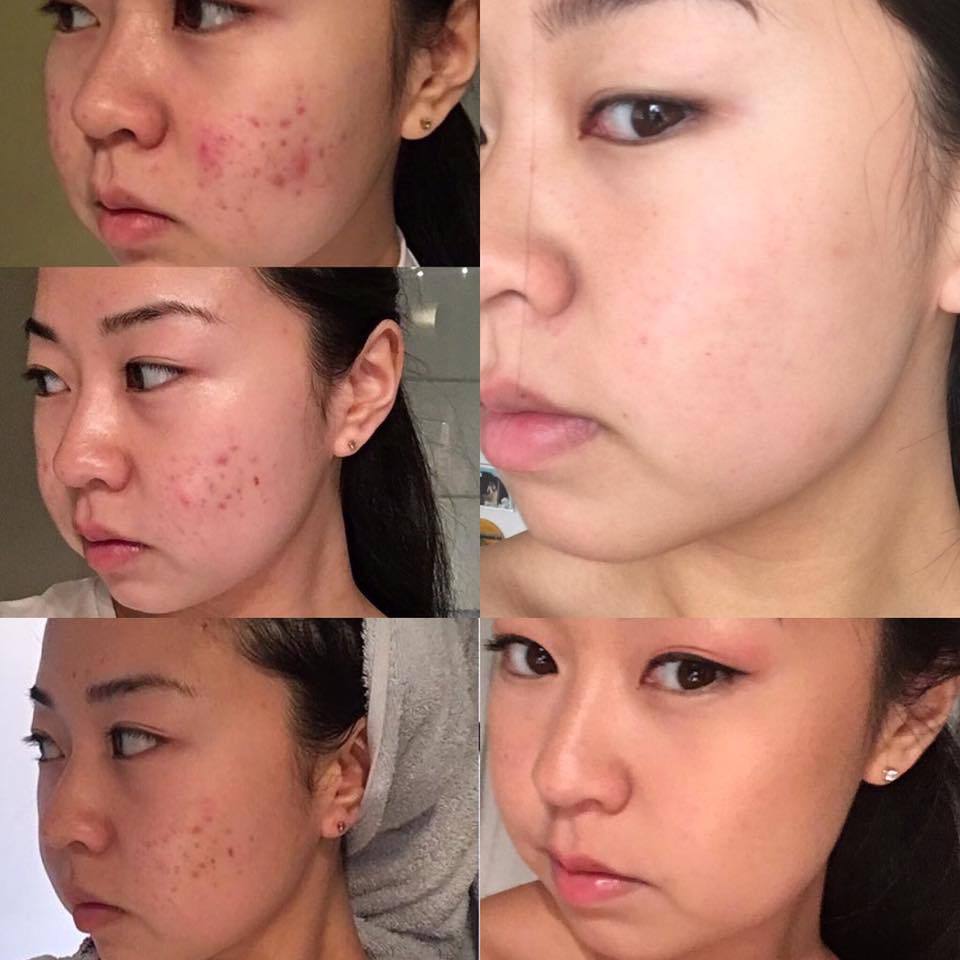 Kết quả sau khi dùng sản phẩm