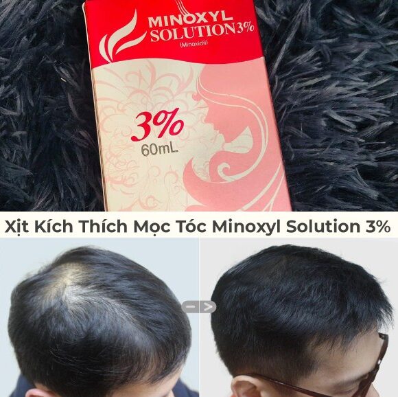 Hiệu quả nhanh sau thời gian ngắn sử dụng