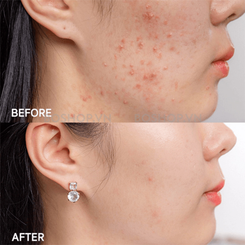 Kết quả thực tế sau khi sử dụng