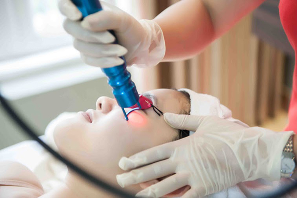 Phương pháp điều trị nám bằng Laser truyền thống