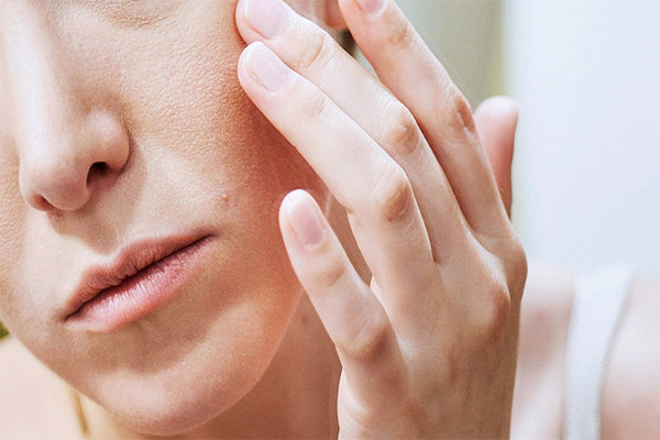 Không nên gãi khi da mặt đang bị ngứa do dị ứng
