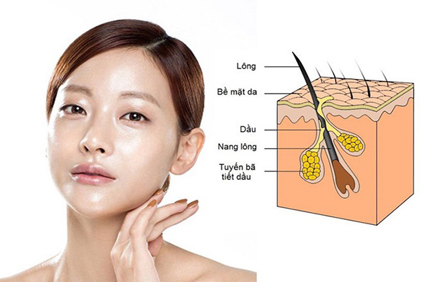 Da dầu dễ nổi mụn do lỗ chân lông bị bít tắc