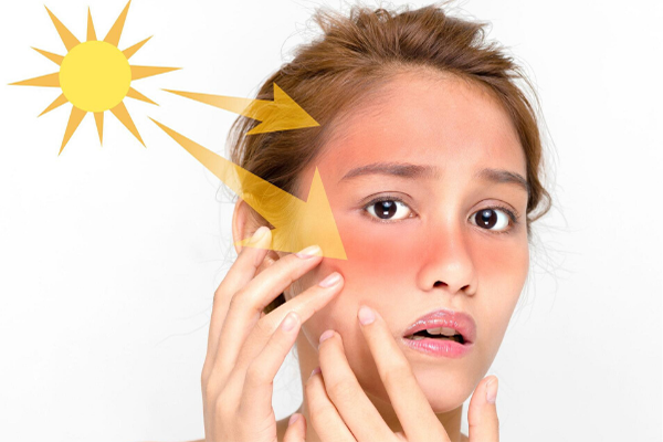 Da bị bắt nắng khi dùng lá trầu không trị nám