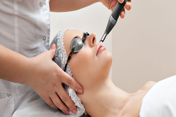 Trị nám bằng laser là phương pháp phổ biến