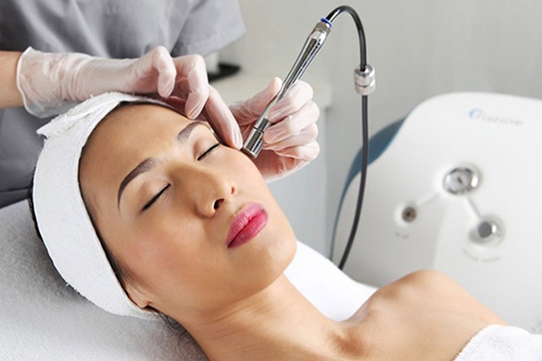 Trị nám da bằng tia laser