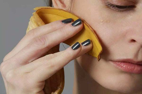 Sử dụng trực tiếp vỏ chuối lên phần da cần điều trị