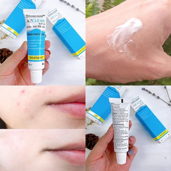 Đọc kỹ hướng dẫn Kem bôi Azclear 20 trên vỏ hộp