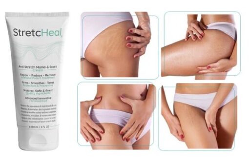 Kem Bôi Rạn Da Chuyên Dụng StretcHeal 180ml Của Mỹ