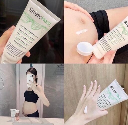 Kem Bôi Rạn Da Chuyên Dụng StretcHeal 180ml Của Mỹ