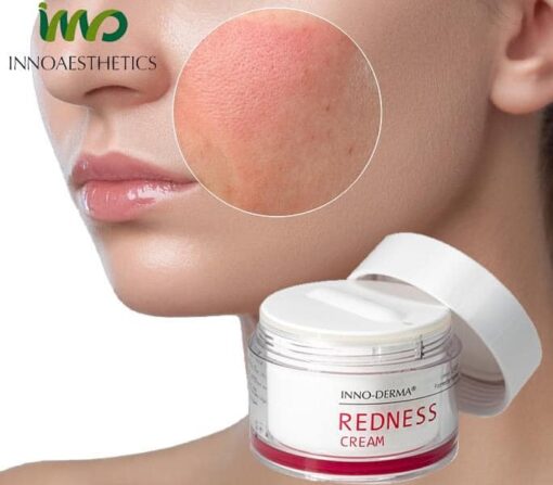 Kem Innoaesthetics Redness Cream 50ml Hỗ Trợ Phục Hồi Da [Chính Hãng]