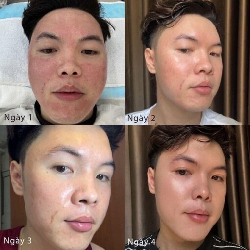 Kem Dưỡng Phục Hồi Evenswiss Rich Regenerating Cream 50ml