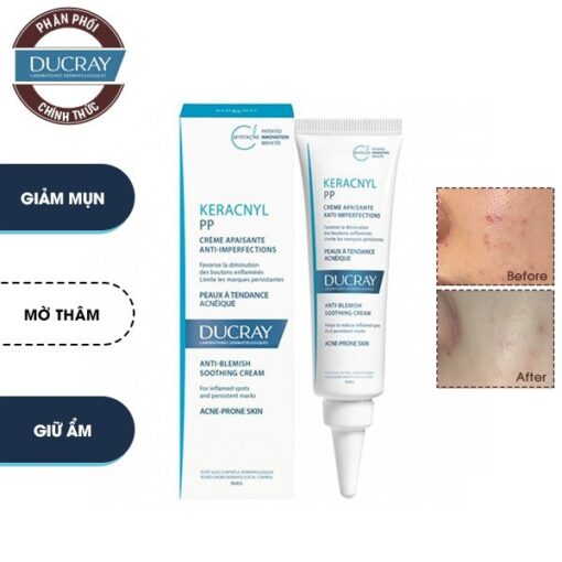 Kem Giảm Mụn Mờ Thâm Ducray Keracnyl PP+ Anti-Blemish Soothing Cream 30ml