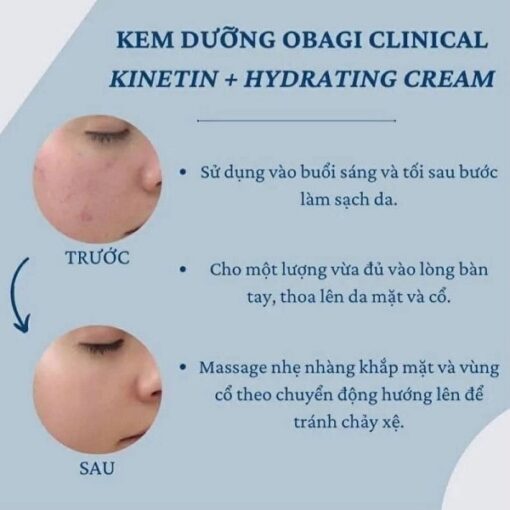 Obagi Clinical Kinetin Hydrating 50ml Kem Dưỡng Phục Hồi Da [Chính Hãng]