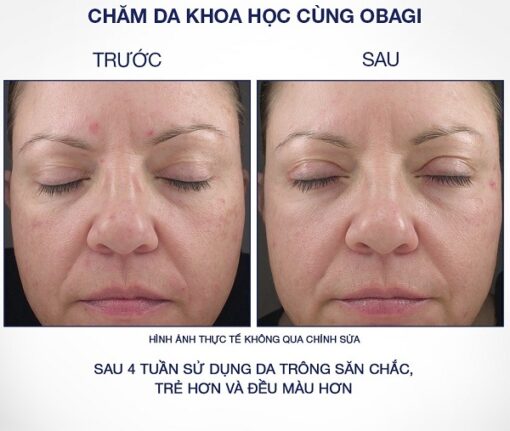 Kem dưỡng Obagi 360 Retinol 0.5 Hỗ Trợ Trẻ Hóa Da [Hàng Công Ty]