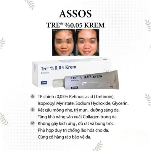Assos Tre 0.05 % Krem Kem Hỗ Trợ Giảm Mụn, Trẻ Hóa Da 30g