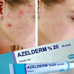kem ho tro ngua mun azelderm 20 azelaic acid 6789c7f590de8 17012025100109